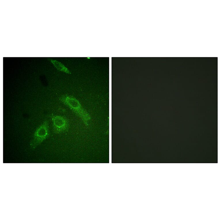 Immunofluorescence - Anti-FAK (phospho Ser910) Antibody (A0924) - Antibodies.com