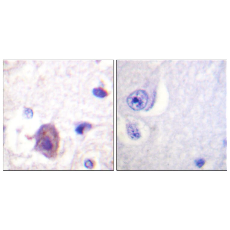 Immunohistochemistry - Anti-FAK (phospho Ser910) Antibody (A0924) - Antibodies.com