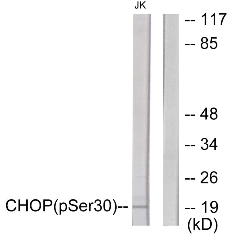 Western Blot - Anti-CHOP (phospho Ser30) Antibody (A0863) - Antibodies.com