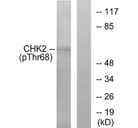 Western Blot - Anti-Chk2 (phospho Thr68) Antibody (A7044) - Antibodies.com