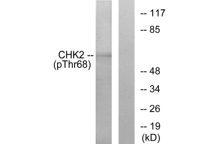 Western Blot - Anti-Chk2 (phospho Thr68) Antibody (A7044) - Antibodies.com