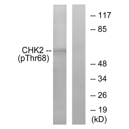 Western Blot - Anti-Chk2 (phospho Thr68) Antibody (A7044) - Antibodies.com
