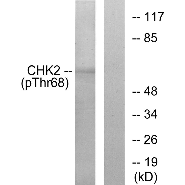 Western Blot - Anti-Chk2 (phospho Thr68) Antibody (A7044) - Antibodies.com