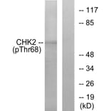 Western Blot - Anti-Chk2 (phospho Thr68) Antibody (A7044) - Antibodies.com