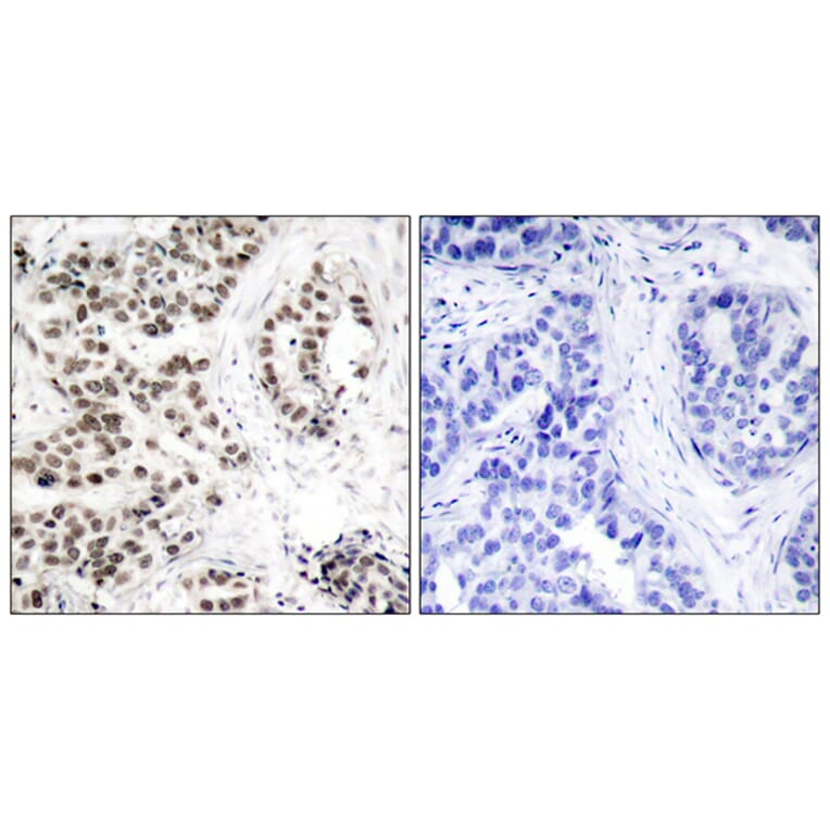 Immunohistochemistry - Anti-Chk2 (phospho Thr68) Antibody (A7044) - Antibodies.com