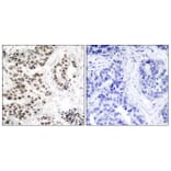 Immunohistochemistry - Anti-Chk2 (phospho Thr68) Antibody (A7044) - Antibodies.com