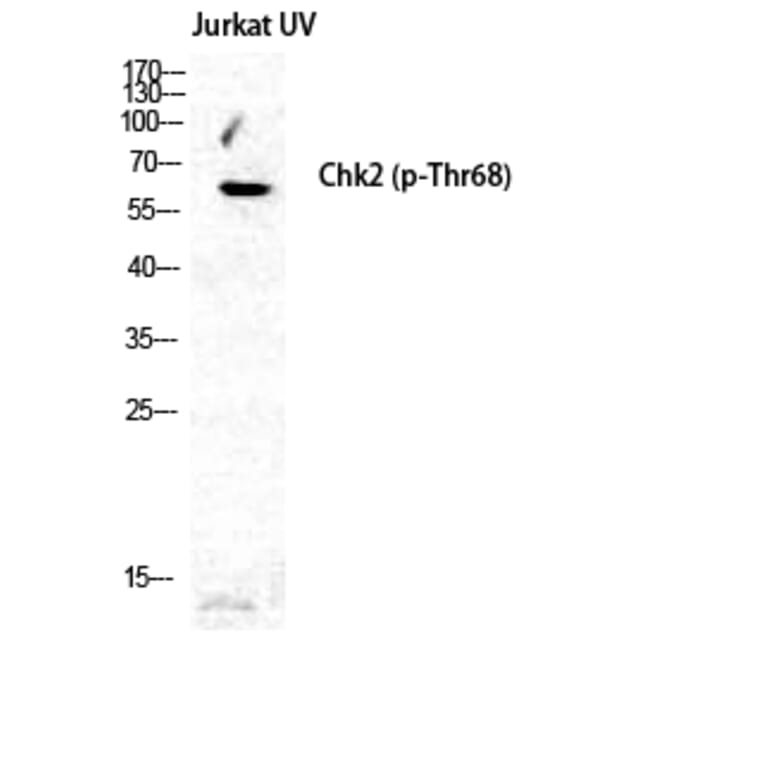 Western Blot - Anti-Chk2 (phospho Thr68) Antibody (A7044) - Antibodies.com