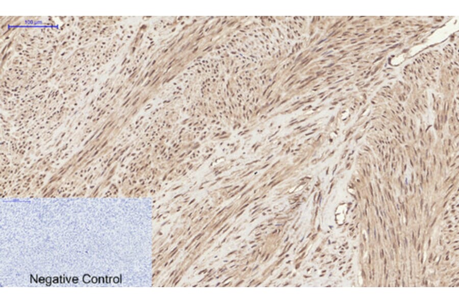 Immunohistochemistry - Anti-Chk2 (phospho Thr68) Antibody (A7044) - Antibodies.com