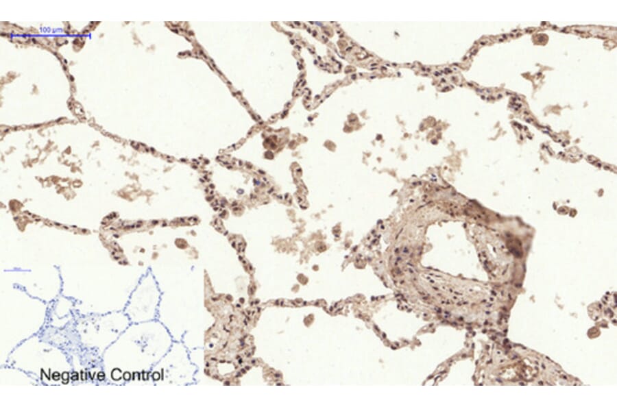 Immunohistochemistry - Anti-Chk2 (phospho Thr68) Antibody (A7044) - Antibodies.com