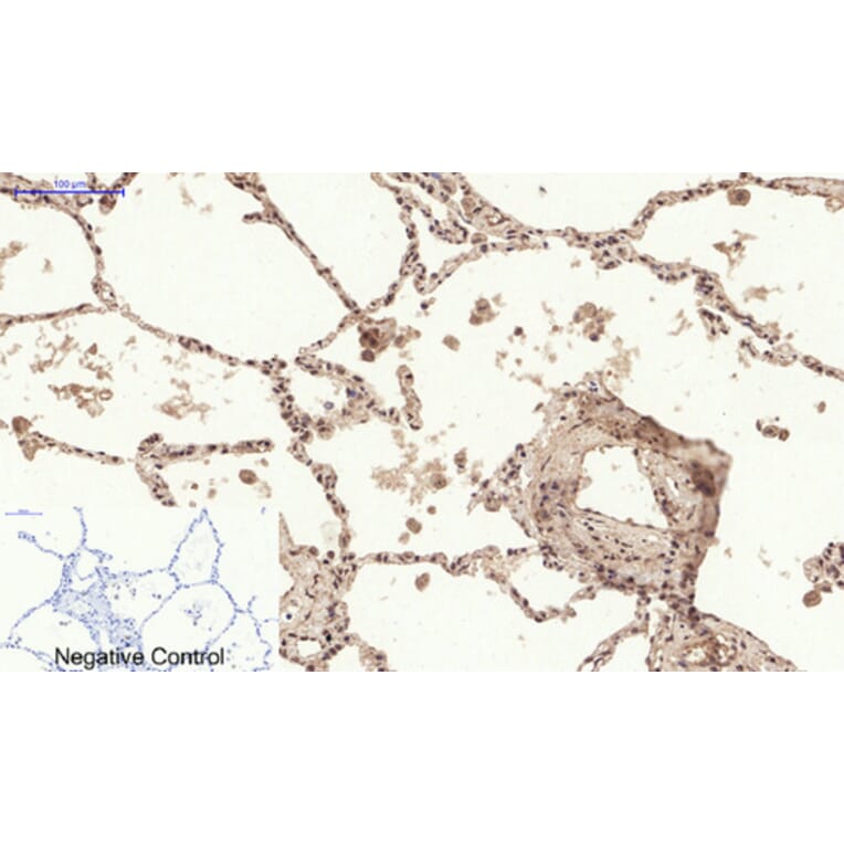 Immunohistochemistry - Anti-Chk2 (phospho Thr68) Antibody (A7044) - Antibodies.com