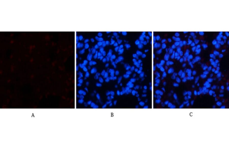 Immunofluorescence - Anti-Chk2 (phospho Thr68) Antibody (A7044) - Antibodies.com