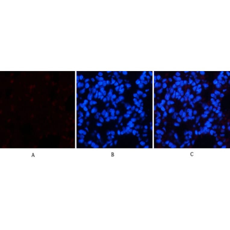 Immunofluorescence - Anti-Chk2 (phospho Thr68) Antibody (A7044) - Antibodies.com