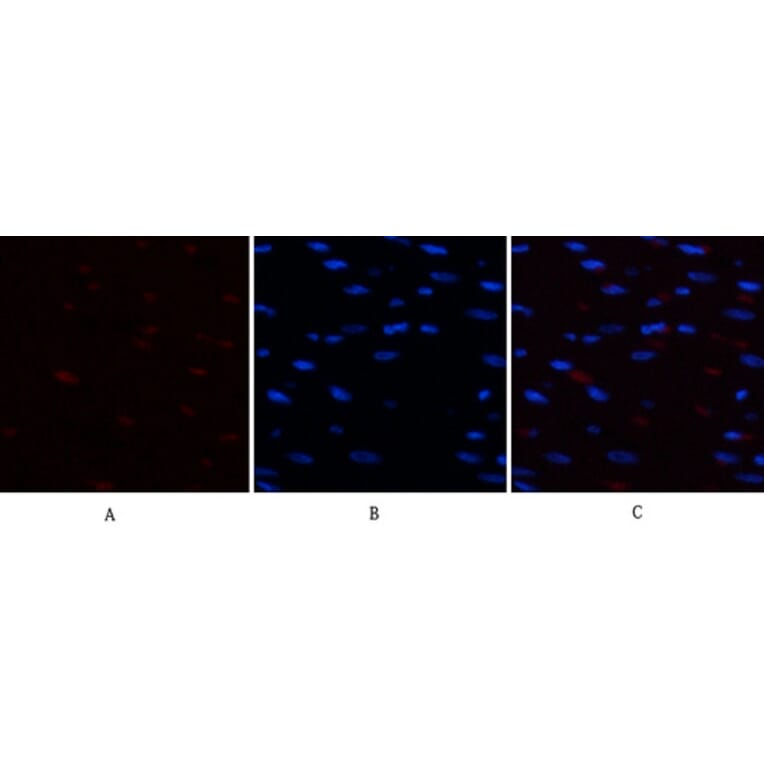 Immunofluorescence - Anti-Chk2 (phospho Thr68) Antibody (A7044) - Antibodies.com