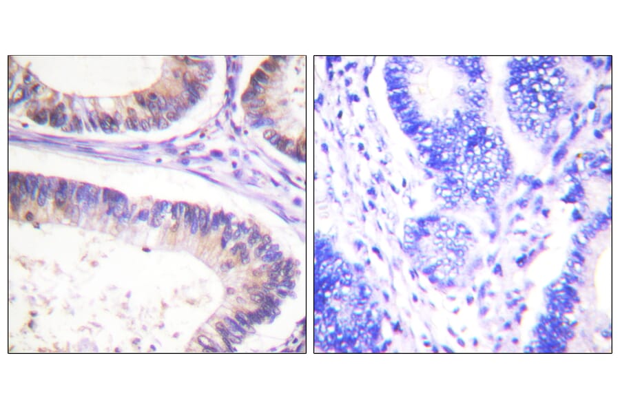 Immunohistochemistry - Anti-CBL (phospho Tyr674) Antibody (A0467) - Antibodies.com