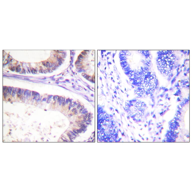 Immunohistochemistry - Anti-CBL (phospho Tyr674) Antibody (A0467) - Antibodies.com