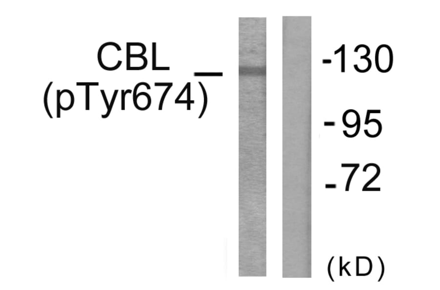 Western Blot - Anti-CBL (phospho Tyr674) Antibody (A0467) - Antibodies.com