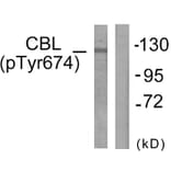 Western Blot - Anti-CBL (phospho Tyr674) Antibody (A0467) - Antibodies.com