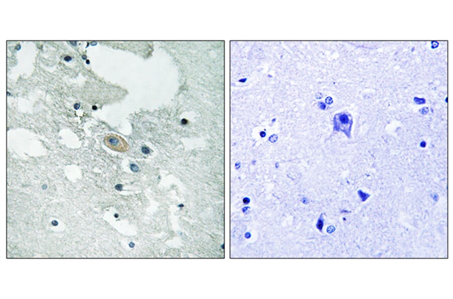 Immunohistochemistry - Anti-BLNK (phospho Tyr84) Antibody (A8216) - Antibodies.com