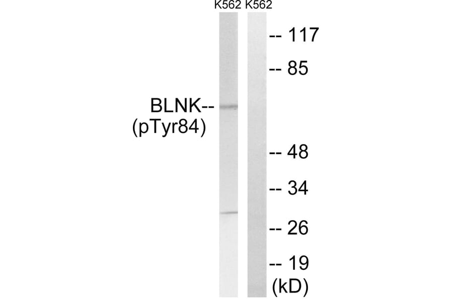 Western Blot - Anti-BLNK (phospho Tyr84) Antibody (A8216) - Antibodies.com