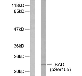Western Blot - Anti-BAD (phospho Ser155) Antibody (A7019) - Antibodies.com
