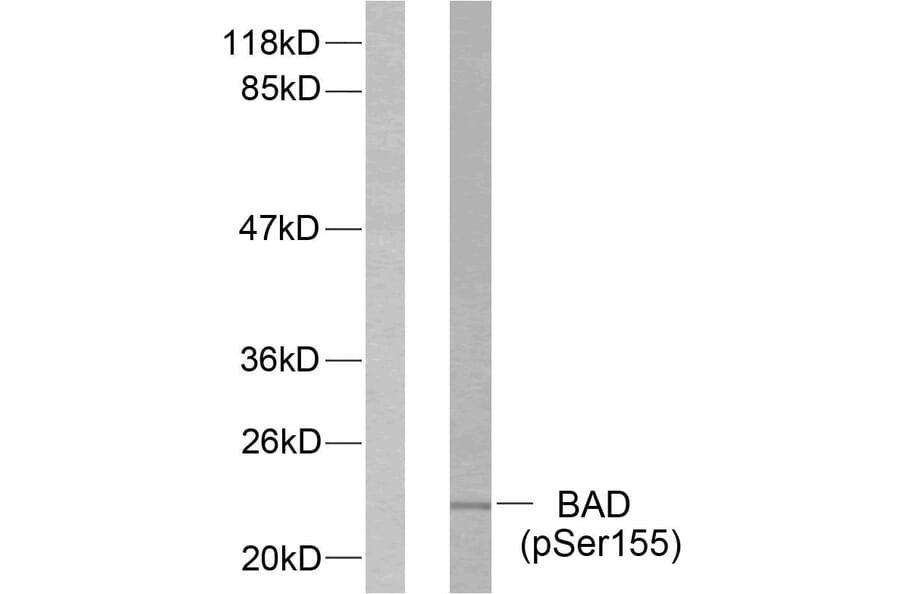 Western Blot - Anti-BAD (phospho Ser155) Antibody (A7019) - Antibodies.com