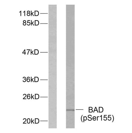 Western Blot - Anti-BAD (phospho Ser155) Antibody (A7019) - Antibodies.com