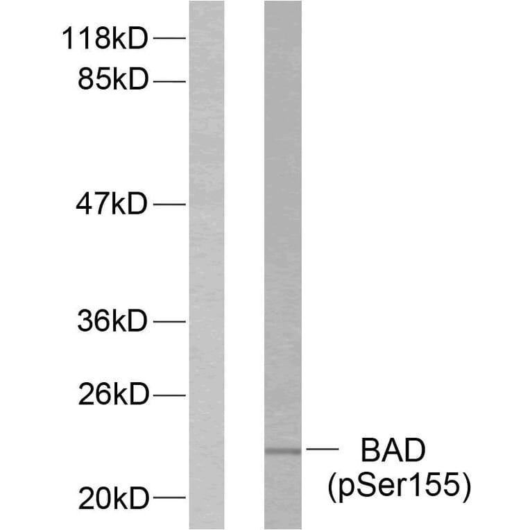 Western Blot - Anti-BAD (phospho Ser155) Antibody (A7019) - Antibodies.com