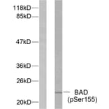 Western Blot - Anti-BAD (phospho Ser155) Antibody (A7019) - Antibodies.com