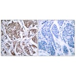 Immunohistochemistry - Anti-BAD (phospho Ser155) Antibody (A7019) - Antibodies.com