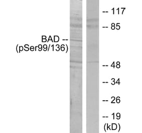 Western Blot - Anti-BAD (phospho Ser136) Antibody (A7021) - Antibodies.com