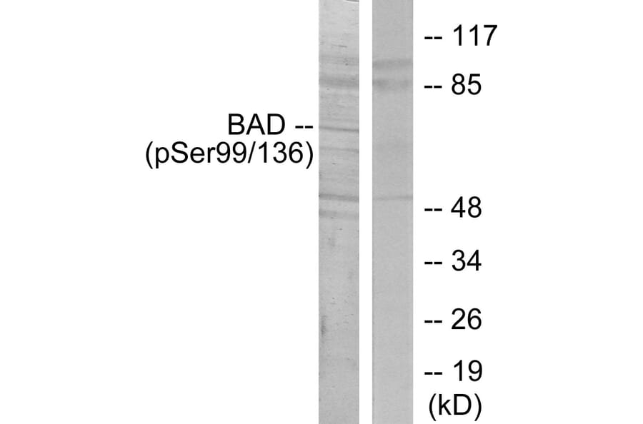 Western Blot - Anti-BAD (phospho Ser136) Antibody (A7021) - Antibodies.com