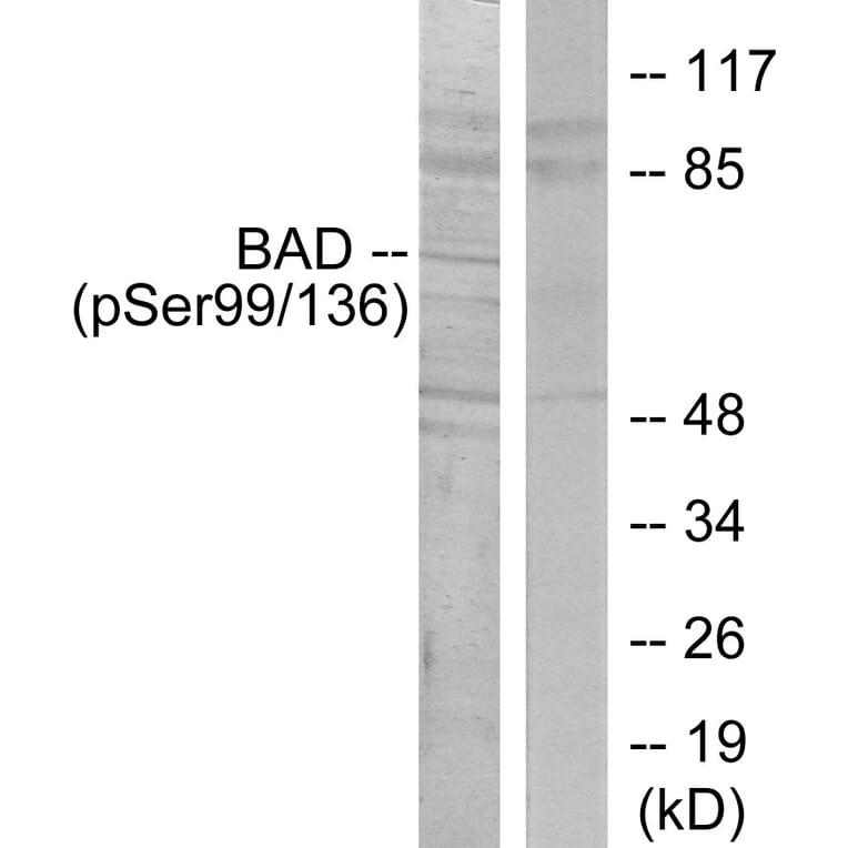 Western Blot - Anti-BAD (phospho Ser136) Antibody (A7021) - Antibodies.com