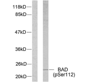 Western Blot - Anti-BAD (phospho Ser112) Antibody (A7020) - Antibodies.com