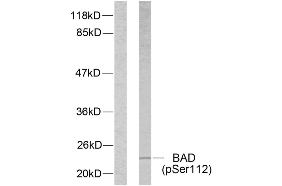 Western Blot - Anti-BAD (phospho Ser112) Antibody (A7020) - Antibodies.com