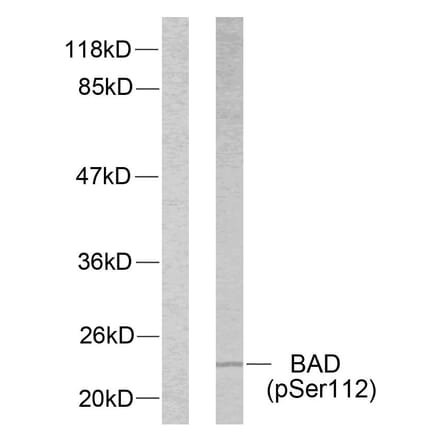 Western Blot - Anti-BAD (phospho Ser112) Antibody (A7020) - Antibodies.com