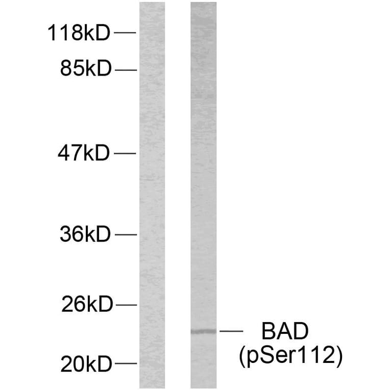 Western Blot - Anti-BAD (phospho Ser112) Antibody (A7020) - Antibodies.com