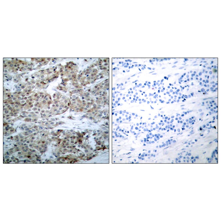 Immunohistochemistry - Anti-BAD (phospho Ser112) Antibody (A7020) - Antibodies.com