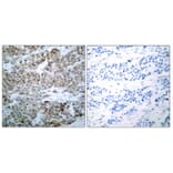 Immunohistochemistry - Anti-BAD (phospho Ser112) Antibody (A7020) - Antibodies.com