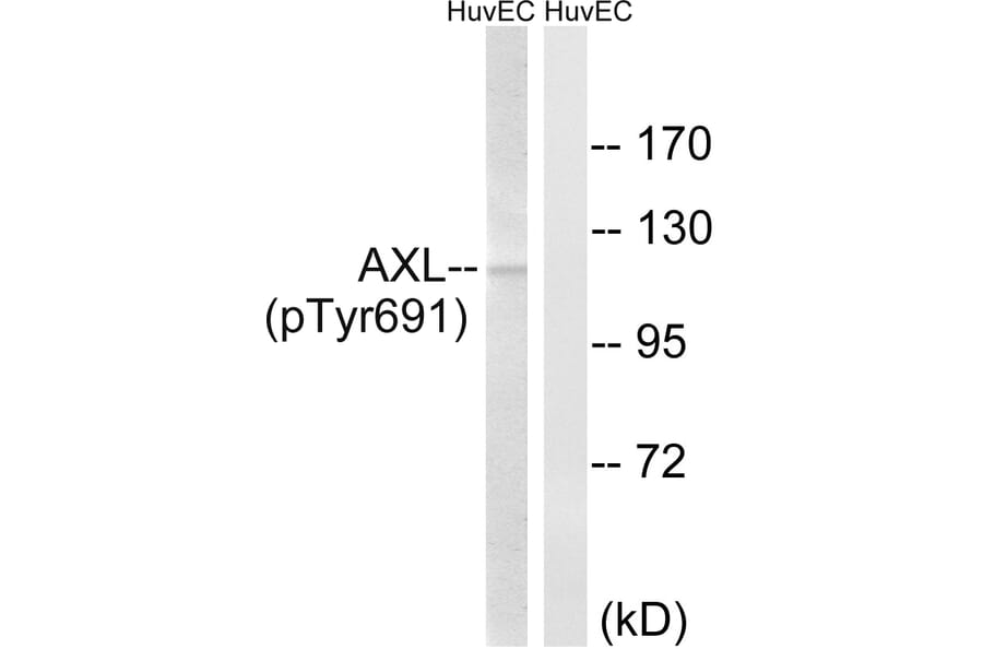 Western Blot - Anti-AXL (phospho Tyr691) Antibody (A8079) - Antibodies.com