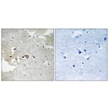 Immunohistochemistry - Anti-AXL (phospho Tyr691) Antibody (A8079) - Antibodies.com