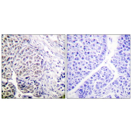 Immunohistochemistry - Anti-AurB (phospho Tyr12) Antibody (A1133) - Antibodies.com