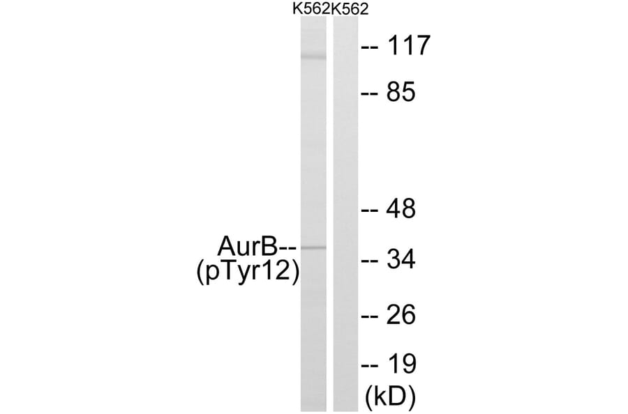 Western Blot - Anti-AurB (phospho Tyr12) Antibody (A1133) - Antibodies.com