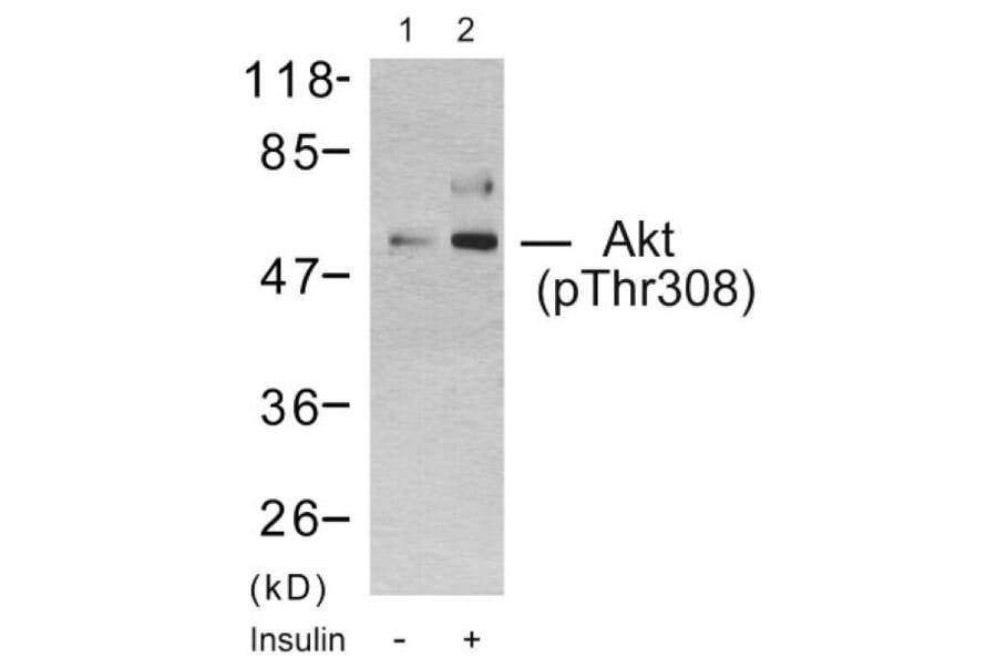 Western Blot - Anti-Akt (phospho Thr308) Antibody (A7005) - Antibodies.com