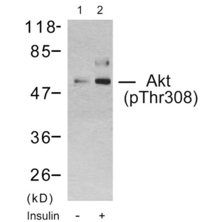 Western Blot - Anti-Akt (phospho Thr308) Antibody (A7005) - Antibodies.com