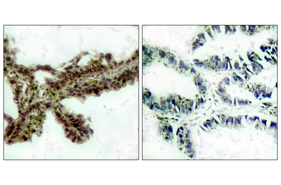 Immunohistochemistry - Anti-Akt (phospho Thr308) Antibody (A7005) - Antibodies.com