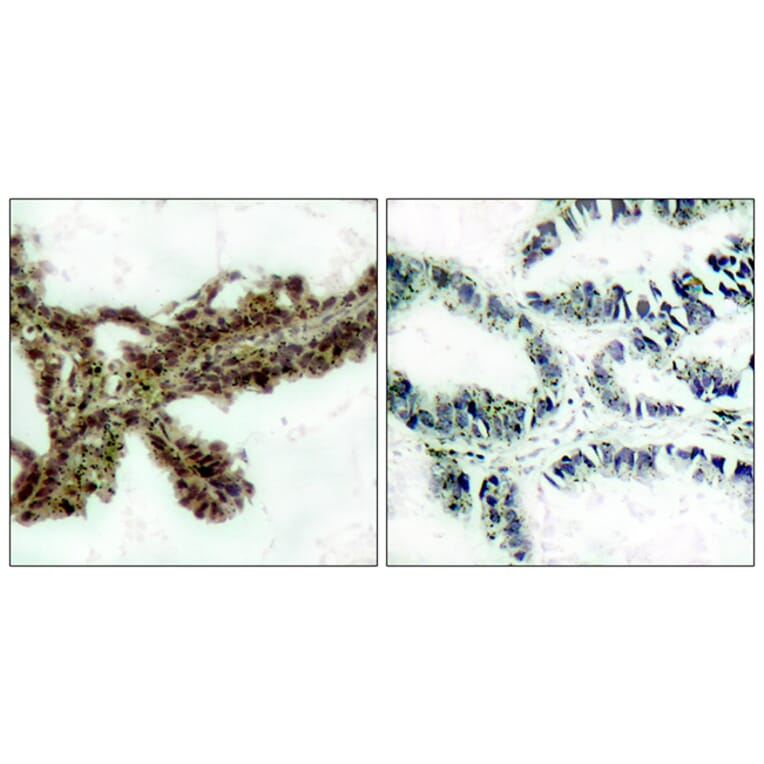 Immunohistochemistry - Anti-Akt (phospho Thr308) Antibody (A7005) - Antibodies.com