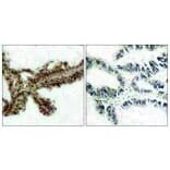Immunohistochemistry - Anti-Akt (phospho Thr308) Antibody (A7005) - Antibodies.com