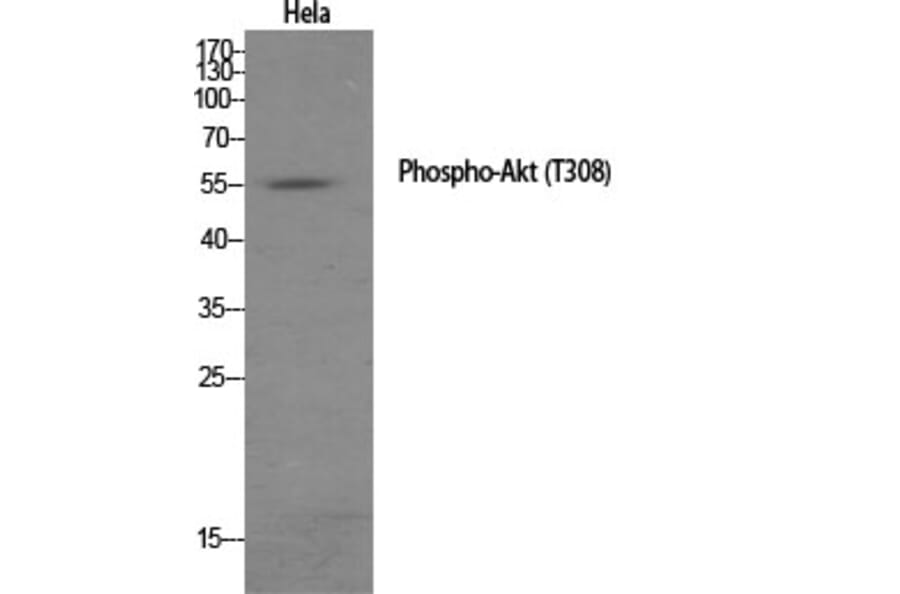 Western Blot - Anti-Akt (phospho Thr308) Antibody (A7005) - Antibodies.com