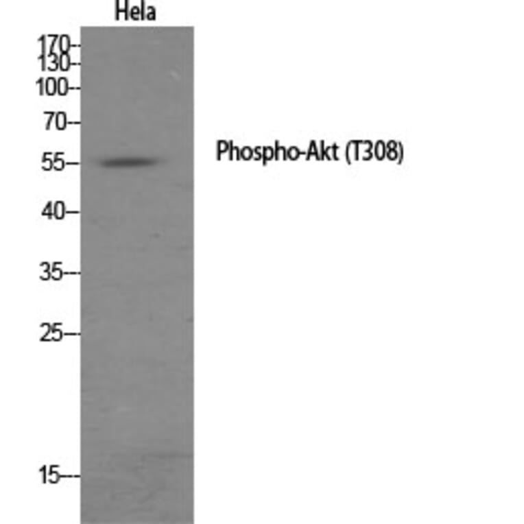Western Blot - Anti-Akt (phospho Thr308) Antibody (A7005) - Antibodies.com