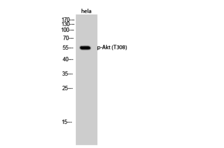 Western Blot - Anti-Akt (phospho Thr308) Antibody (A7005) - Antibodies.com